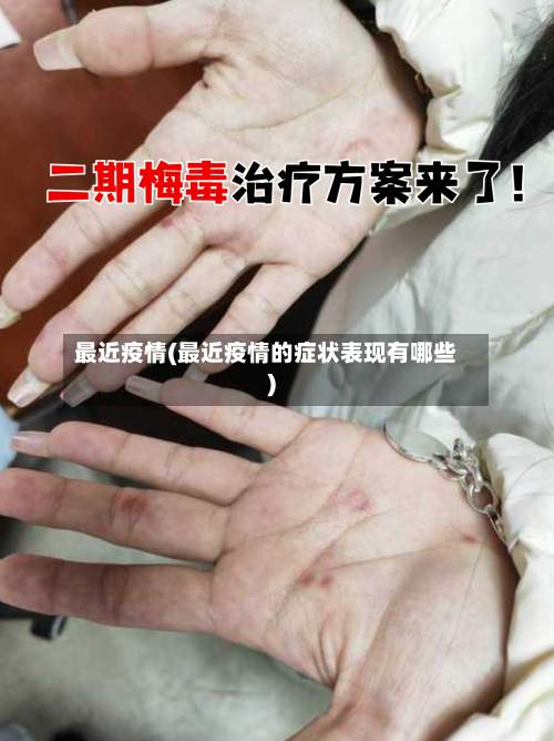 最近疫情(最近疫情的症状表现有哪些)-第1张图片