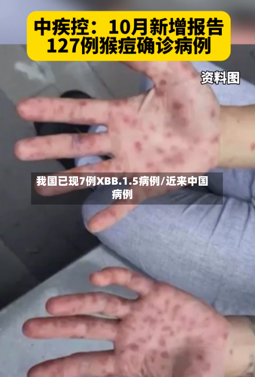 我国已现7例XBB.1.5病例/近来中国病例-第2张图片