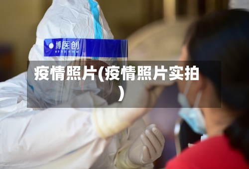 疫情照片(疫情照片实拍)-第1张图片