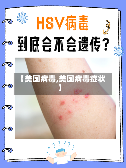 【美国病毒,美国病毒症状】-第2张图片